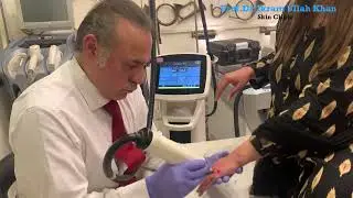 Erbium Yag Laser Turns Back Time on Hands #wrinkles #lasertreatment