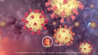 RNA Sequencing Prep Kits: Improving Efficiency in Pathogen Detection
