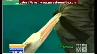 Pelican attacks man