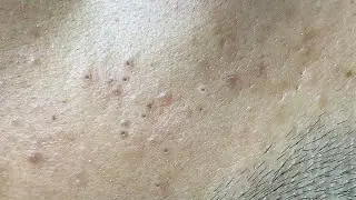 Satisfying Relaxing with Sac Dep Spa 