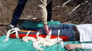 Первая помощь при переломах