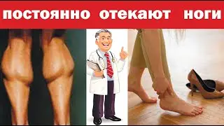 A penny cure for swollen feet. Affordable remedy.