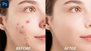Professional Retouching | For Beginner | Photoshop Editing 
