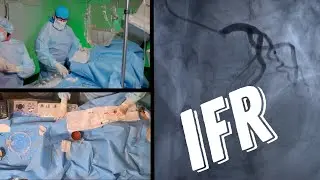 IFR. В операционной Philips