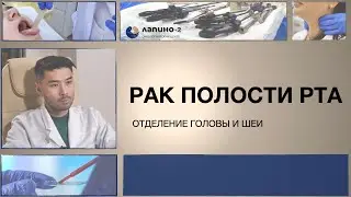 Рак полости рта. Симптомы и лечение в отделении опухолей головы и шеи.