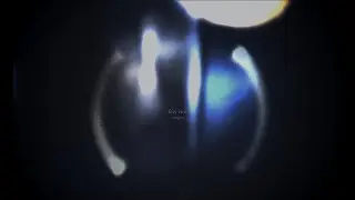 congest - fifty two | eight