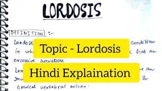 Lordosis | Definition | Causes | Signs & Symptoms | Diagnosis | Treatment |