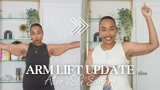 I GOT AN ARM LIFT ! | BRACHIOPLASTY UPDATE | LOOSE SKIN REMOVAL AFTER VSG