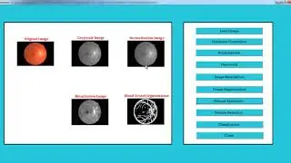 Final Year Project Image Processing | Final Year Project Image Processing Projects