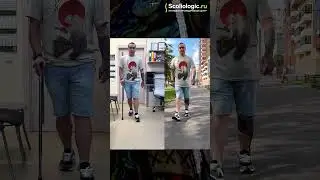 Ортез: самовыражение через дизайн