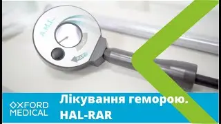 Як вилікувати ГЕМОРОЙ за ОДИН візит? HAL-RAR