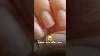 Отслойки на кончике