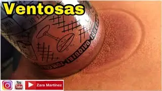 Elimina el dolor con las ventosas, mi experiencia