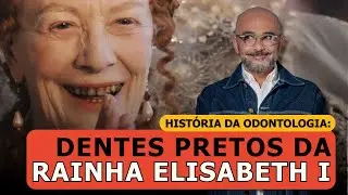 História da Odontologia: Por que os Dentes de Elisabeth I eram Pretos?