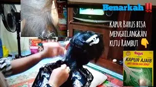 CARA MENGHILANGKAN KUTU RAMBUT (bisakah)MEMAKAI KAPUR AJAIB
