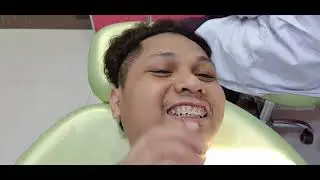 PROCESS OF GETTING BRACES ROAD TO SMILE FOREVER |ADJUSTMENT|PART 3