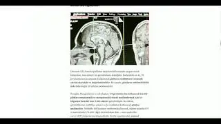 Yapay Zeka ve Radyomiks - (Radiomics and Artificial Intelligence)