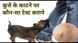 rabies blood test for humans | rabies test kaise hota hai | rabies test