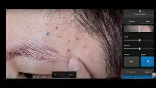 how to edit dark spots in 5 MIN