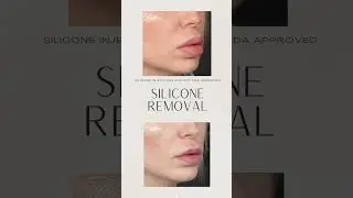 SILICONE REMOVAL in LIPS