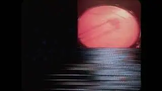 Dead Leaf Echo ~ Boo [Official Video]