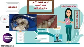 #ادوات_حشو_العصب#dental_assistant #سلسله_مساعد_طبيب_الاسنان