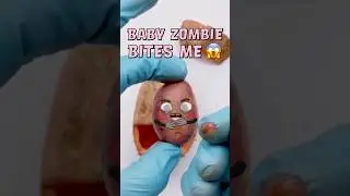BABY ZOMBIE BITES ME💀🥔 - Potato C-section gone wrong!😱 
