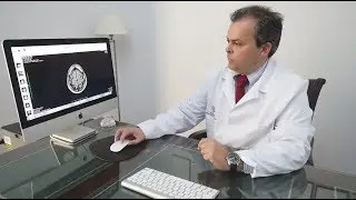 AS Juan Rodríguez Uranga, a neurologist who is a leader in new techniques that treat epilepsy