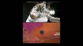 Surgeons, Meet Your Tiny Teammate: The Future of Minimally Invasive Surgery is Here!#Robots