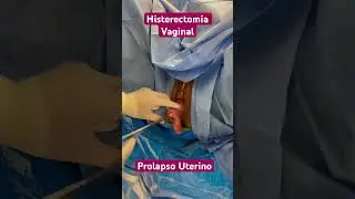 Observe a uterine prolapse