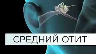 СРЕДНИЙ ОТИТ