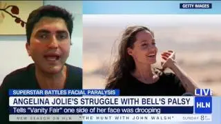 Angelina Jolie's Bell's Palsy Recovery - Dr Babak Azizzadeh featured on MichaeLA