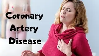 Coronary Artery Disease Symptoms, Causes, & Treatments