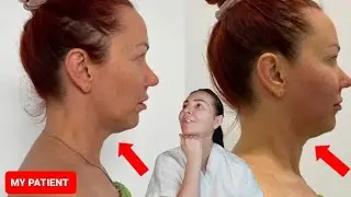 HOW TO reduce SAGGING JOWLS