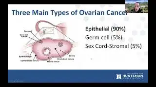 Ovarian Cancer 101