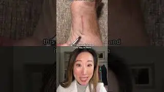 Hair splinters are real things and can get infected 