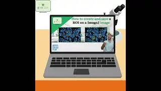 How to create and save a ROI using ImageJ #shorts #imagej #roi #science #analysis #imageanalysis