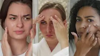Лечение акне - Приветствие