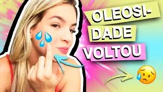 PELE PÓS ROACUTAN, OLEOSIDADE e MANCHAS | 9 MESES PÓS ROACUTAN #ROACUTAN #POSROACUTAN #PELEOLEOSA