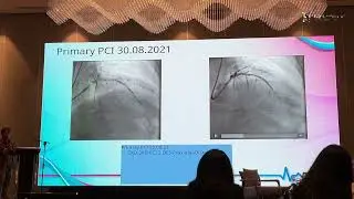 Cardiotalk — Semaglutide in Complex Obesity Case 2