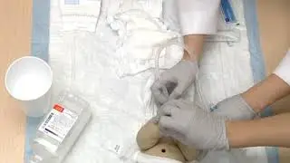 Rectal Irrigation
