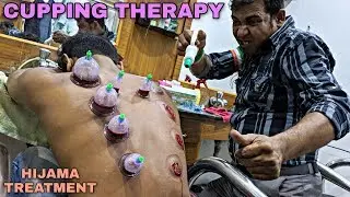 Cupping therapy By asim barber | Hijama treatment | neck & hair cracking | ASMR