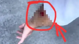 Упал с самоката😕всё видео! Что стало