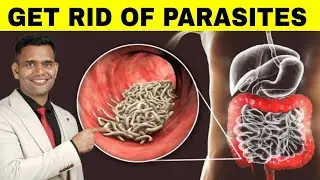 Get Rid Of Parasites Naturally | Best Herbs For Parasites - Dr. Vivek Joshi