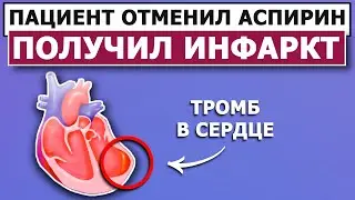 Инфаркт миокарда | Аспирин | Последствия