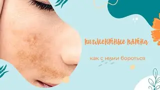 Причины пигментных пятен и как от них избавиться.