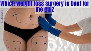 which weight loss surgery is best for me quiz