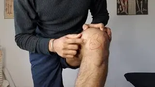 4 Signs You Have a Knee Meniscus Cartilage Tear | Knee Clicks Feat. Harbir Singh