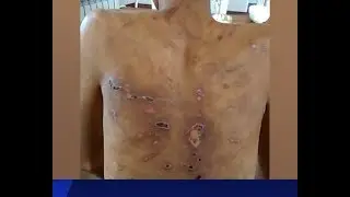 Молдо жин чыгарам деп сабай берип, баланы майып кылып салган.