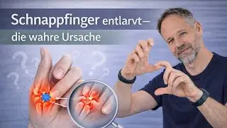 Wie kommt es zum Schnappfinger? Verstehe jetzt die wahre Ursache ✅